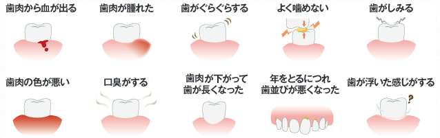 歯周病の症状