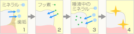 フッ素塗布